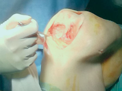 Corea Instruir ladrar Cirugía Artroscópica de rodilla – Edorta Esnal